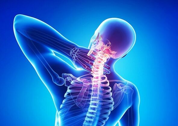Douleur dans la colonne cervicale avec ostéochondrose