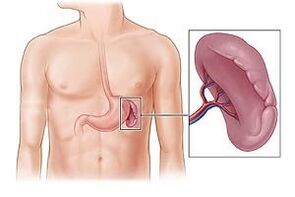 Pathologie de la rate comme cause de douleur sous l'omoplate gauche