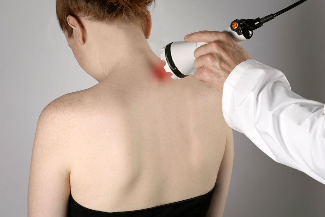 Traitement physiothérapeutique de l'ostéochondrose cervicale